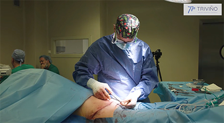 forma optima a cada individuo | Diferencias entre abdominoplastia y miniabdominoplastia 